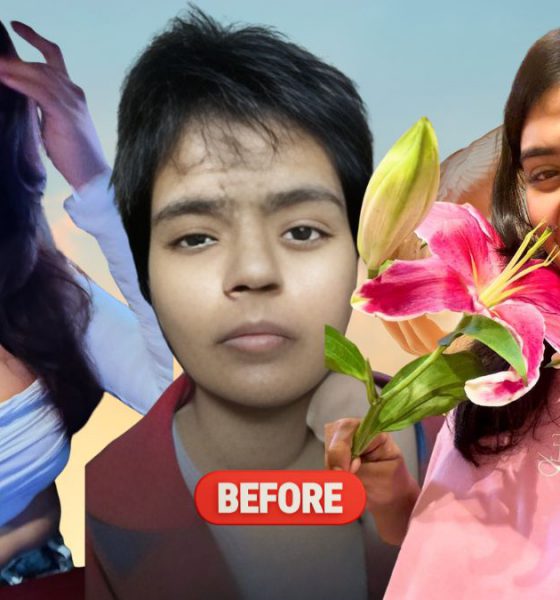 Varsha Shekhawat: From 55 Stitches to Self-Made Strength, A Story That Refuses Sympathy