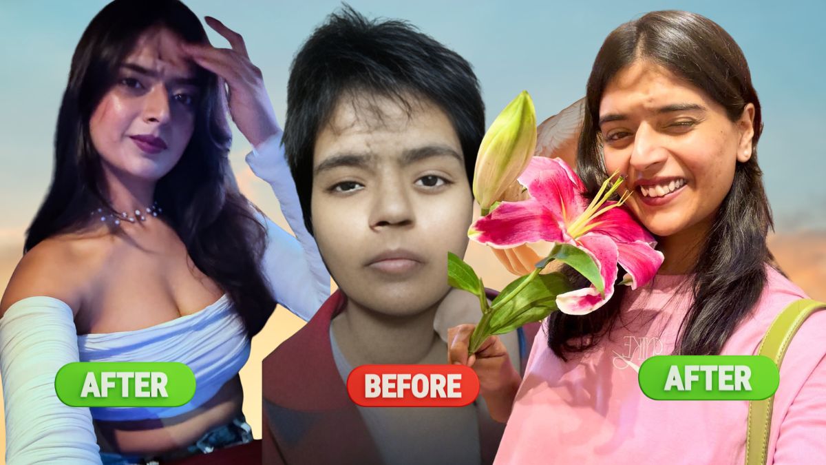 Varsha Shekhawat: From 55 Stitches to Self-Made Strength, A Story That Refuses Sympathy